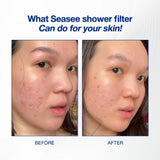 SEASEE Shower Filter Kit - Basic